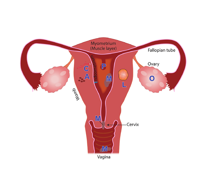 menstrual