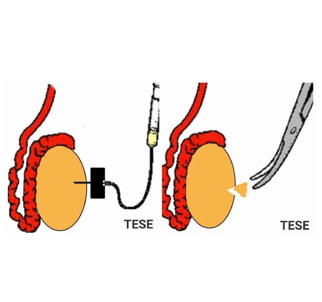 tesa